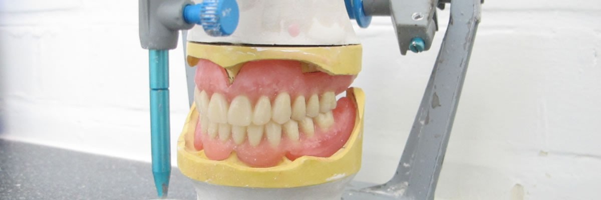 Wax Spacer Designs In 
      Complete Dentures Amherst MA 1003